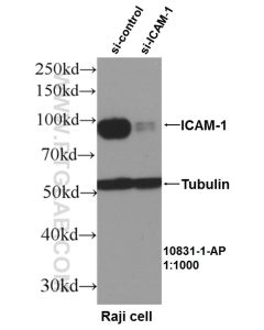 ICAM-1/CD54 Polyclonal antibody proteintech 10831-1-AP