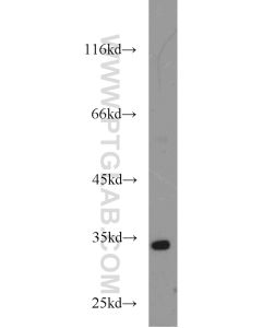 HEY2 Polyclonal antibody proteintech 10597-1-AP