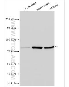 IFT81 Polyclonal antibody proteintech 11744-1-AP