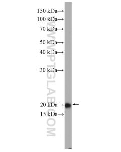 RAB22A Polyclonal antibody proteintech 12125-1-AP