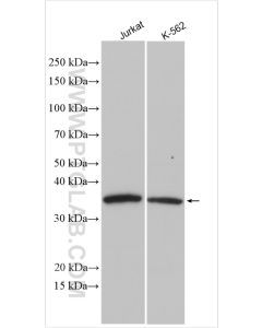 CDK6 Polyclonal antibody proteintech 14052-1-AP