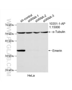 Emerin Polyclonal antibody proteintech 10351-1-AP