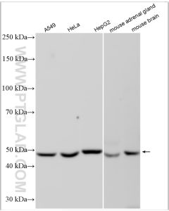 CYP17A1 Polyclonal antibody proteintech 14447-1-AP