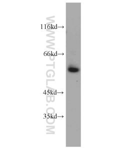 VEGFR-1/FLT-1 Polyclonal antibody proteintech 13687-1-AP