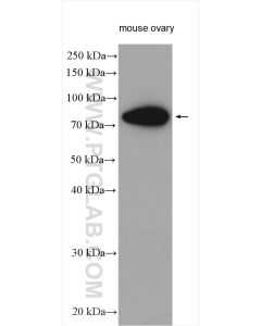 FSHR Polyclonal antibody proteintech 22665-1-AP
