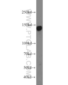 AXL Polyclonal antibody proteintech 13196-1-AP