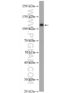YTHDC1 Polyclonal antibody proteintech 14392-1-AP