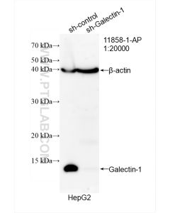 Galectin-1 Polyclonal antibody proteintech 11858-1-AP