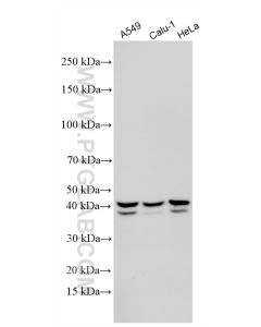 ALKBH5 Polyclonal antibody proteintech 16837-1-AP