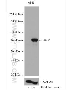 OAS2 Polyclonal antibody proteintech 19279-1-AP