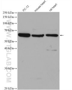 FOXO4 Polyclonal antibody proteintech 21535-1-AP