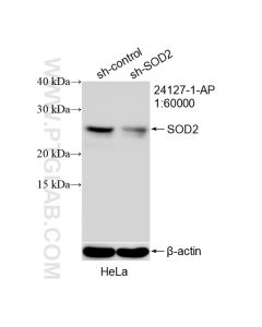 SOD2 Polyclonal antibody proteintech 24127-1-AP