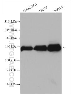 MGEA5 Polyclonal antibody proteintech 14711-1-AP