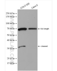 TMPRSS2 Polyclonal antibody proteintech 14437-1-AP