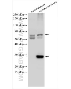 CD63 Polyclonal antibody proteintech 25682-1-AP