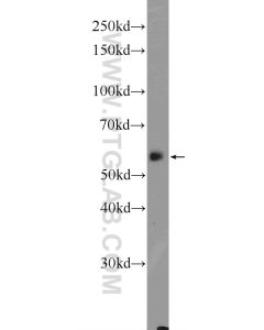 CYP27A1 Polyclonal antibody proteintech 14739-1-AP