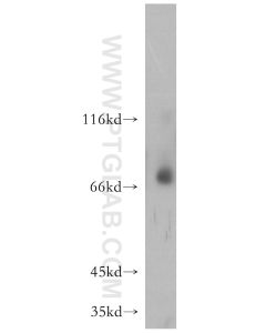 MMP8 Polyclonal antibody proteintech 17874-1-AP