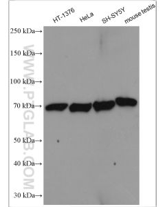 LSS Polyclonal antibody proteintech 13715-1-AP