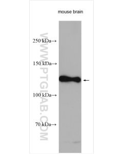 Cleaved Notch1 Polyclonal antibody proteintech 10062-2-AP