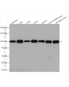 ACTN4 Polyclonal antibody proteintech 19096-1-AP