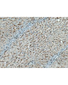 CD14 Polyclonal antibody proteintech 17000-1-AP