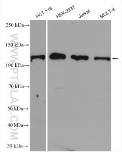 CP110 Polyclonal antibody proteintech 12780-1-AP