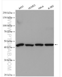 RRM2 Polyclonal antibody proteintech 11661-1-AP