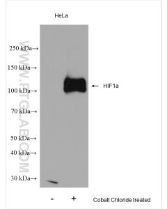 HIF-1 alpha Polyclonal antibody proteintech 20960-1-AP