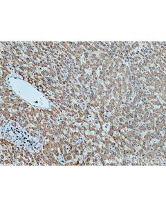 HMGCR Polyclonal antibody proteintech 13533-1-AP