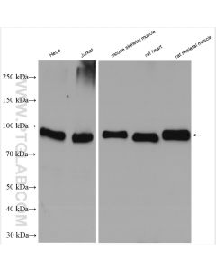 GYS1 Polyclonal antibody proteintech 10566-1-AP