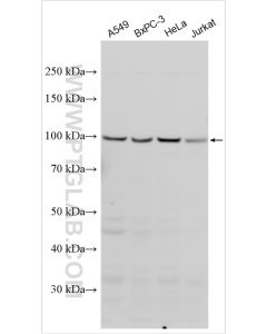AXIN2 Polyclonal antibody proteintech 20540-1-AP