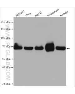 SDHA Polyclonal antibody proteintech 14865-1-AP