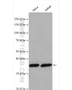 PYCR2 Polyclonal antibody proteintech 17146-1-AP