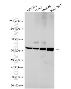 ACSL3 Polyclonal antibody proteintech 20710-1-AP
