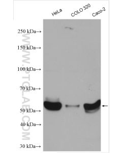 KLF5 Polyclonal antibody proteintech 21017-1-AP