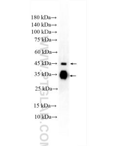 Clusterin Polyclonal antibody proteintech 30339-1-AP