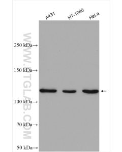 STAT2 Polyclonal antibody proteintech 16674-1-AP