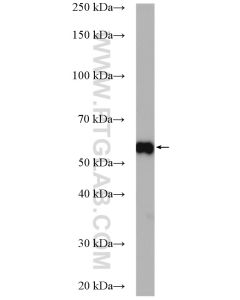 ETV4 Polyclonal antibody proteintech 10684-1-AP