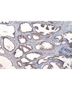 SMO Polyclonal antibody proteintech 20787-1-AP