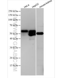 Alpha-1-Antitrypsin Polyclonal antibody proteintech 16382-1-AP