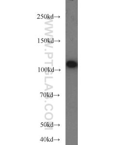 FUT4 Polyclonal antibody proteintech 19497-1-AP