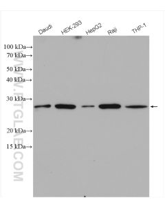 MAD2L1 Polyclonal antibody proteintech 10337-1-AP