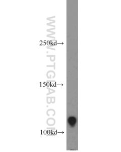 RB1 Polyclonal antibody proteintech 17218-1-AP