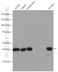 NDE1 Polyclonal antibody proteintech 10233-1-AP