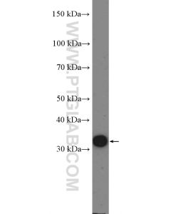 Cyclin D3 Polyclonal antibody proteintech 26755-1-AP