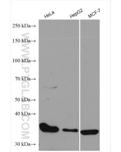 CDK4 Polyclonal antibody proteintech 11026-1-AP