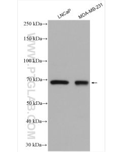 MMP-9 (N-terminal) Polyclonal antibody proteintech 10375-2-AP