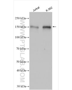 NFATC3 Polyclonal antibody proteintech 18222-1-AP