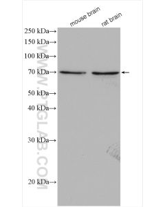 CHAT Polyclonal antibody proteintech 20747-1-AP
