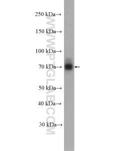 NR4A1 Polyclonal antibody proteintech 25851-1-AP